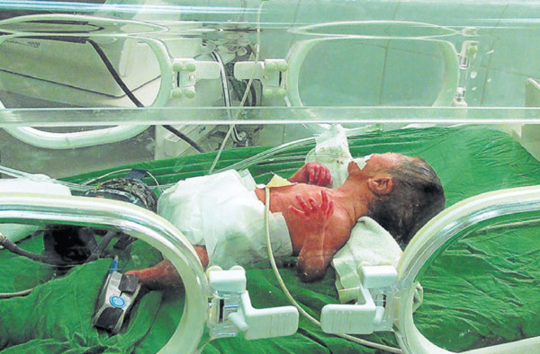 En Honduras, dan por muerta a bebé que 'revive” en su entierro