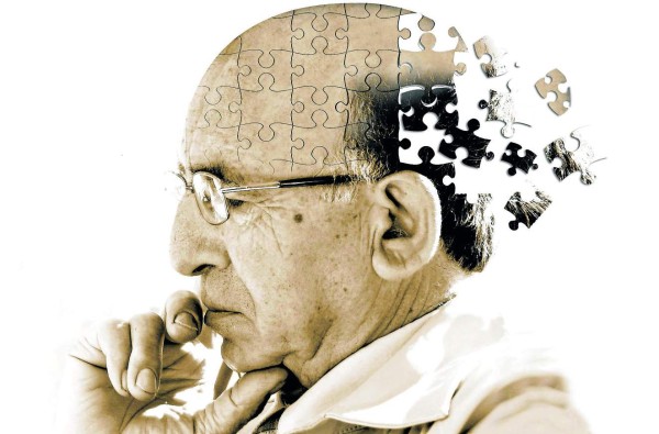 Las pruebas de memoria y de pensamiento podrían ofrecer pistas sobre el riesgo de Alzheimer