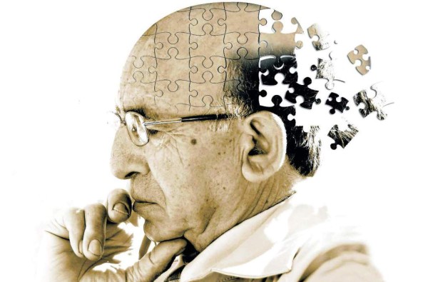 Estudio revela el primer síntoma de Alzheimer