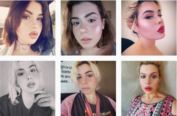 Mujeres que le ganaron a la obesidad