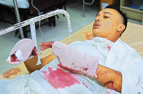 Lo atacan con arma blanca en casa de unos amigos