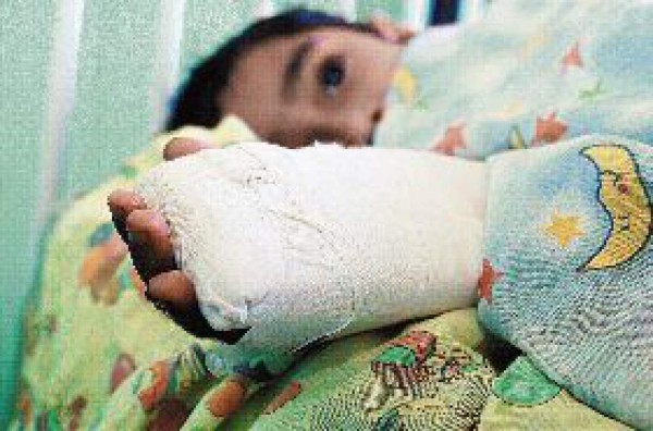 Madre quema a su hija con agua caliente