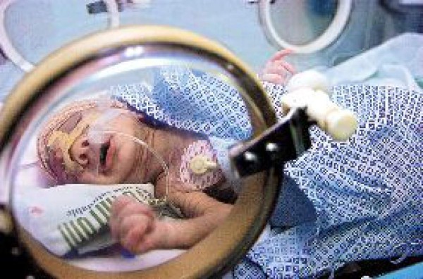 Operan a niña que nació con tumor