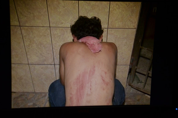 Rescatan joven cuando iban a desmembrarlo en Honduras