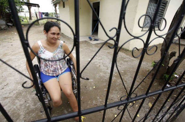 Mujer que marido le cortó los pies vuelve a la vida