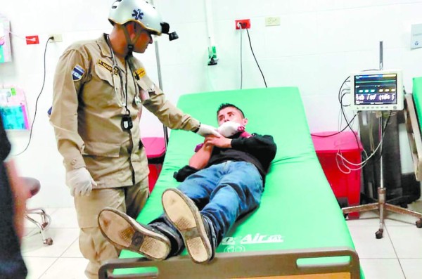 A 36 sube cifra de quemados por la pólvora tras la Nochebuena