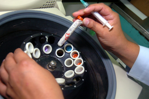 Confirman 20 casos por nuevo rebrote de AH1N1 en Honduras