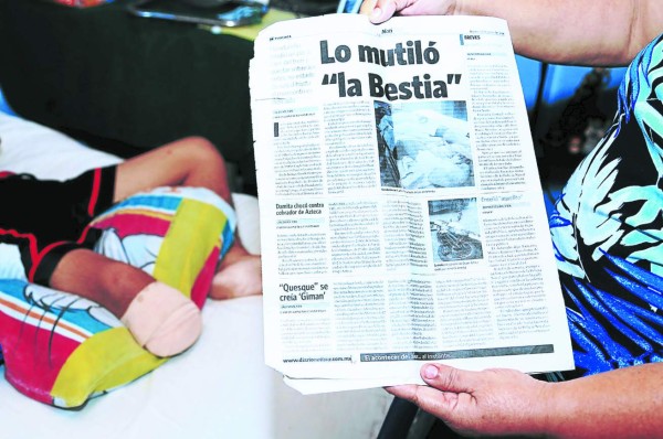 'La bestia me atrapó; nunca volveré a jugar fútbol ni a correr”