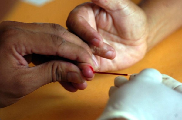 Casi 4,000 personas reciben tratamiento por VIH en San Pedro Sula