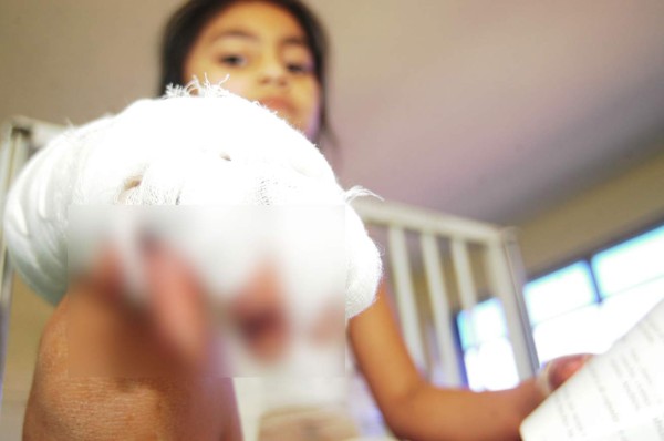 Un éxito, cirugías de mano en el Escuela