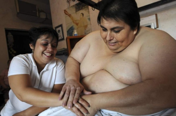 Murió Manuel Uribe, el hombre que llegó a ser el más obeso del mundo