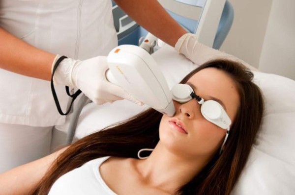 El láser usado para eliminar tatuajes podría ayudar a reducir las cicatrices del acné