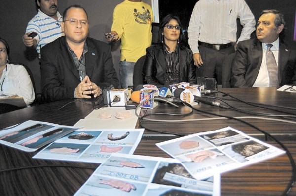 Laprade sí fue asesinado y quemado, confirma Fiscalía