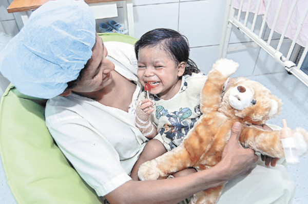 Cinco niños en sala de quemados por pólvora