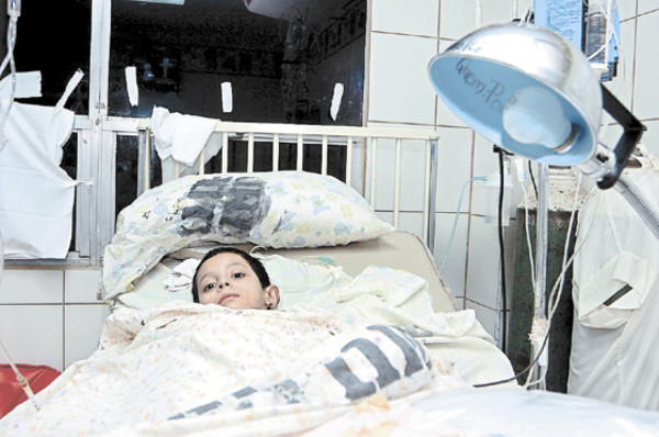 Cinco niños en sala de quemados por pólvora