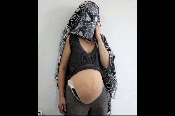 Detienen a una falsa embarazada con 2 kilos de cocaína