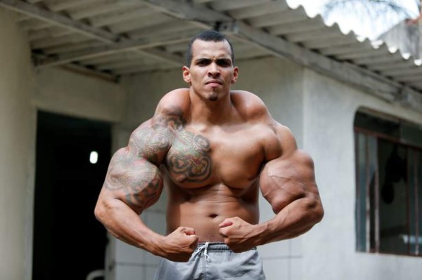 El brasileño que quería parecerse a Hulk y casi pierde sus brazos en el intento