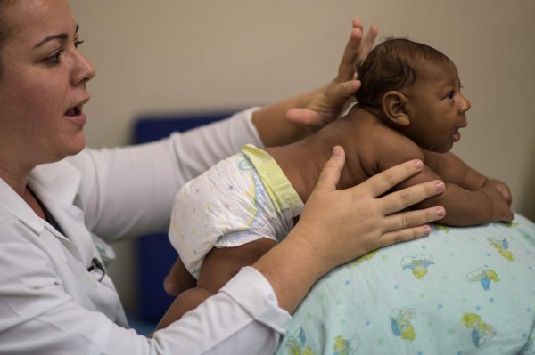 California confirma nacimiento de dos bebés con microcefalia