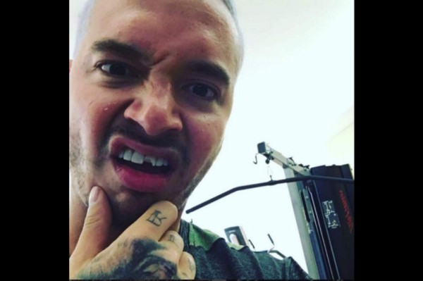 J Balvin recupera el diente que se quebró