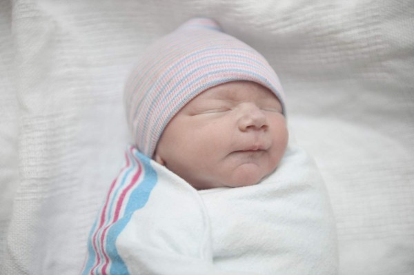 Detectan nuevos problemas de la vista en los bebés infectados con el Zika