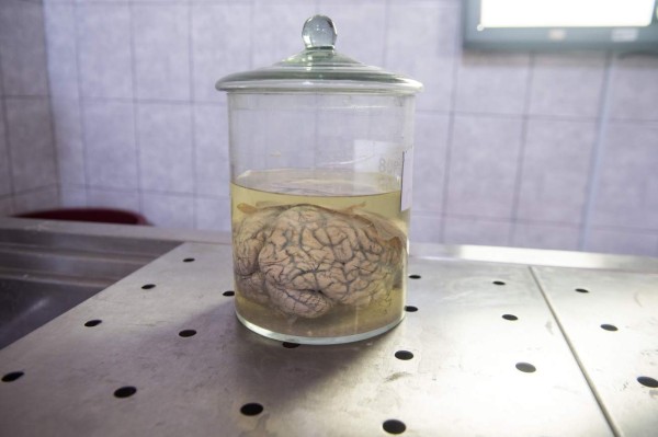 Insólito museo peruano invita a investigar el cerebro