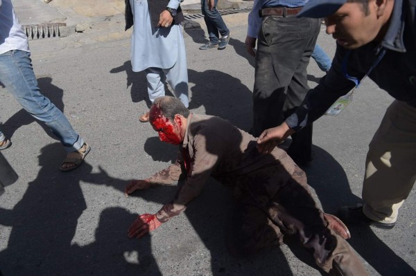 TOPSHOT - EDITORS NOTE: Graphic content / A wounded Afghan man receives assistance at the site of a car bomb attack in Kabul on May 31, 2017.A massive blast rocked Kabul's diplomatic quarter during the morning rush hour on May 31, the latest attack to hit the Afghan capital. / AFP PHOTO / SHAH MARAI