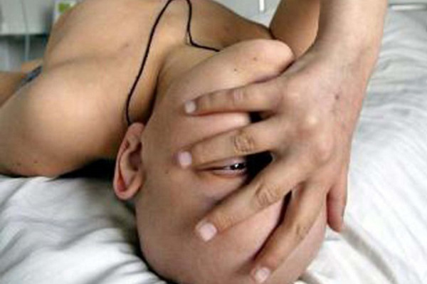 Se abre una puerta al tratamiento de un tipo de leucemia infantil