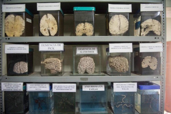 Insólito museo peruano invita a investigar el cerebro