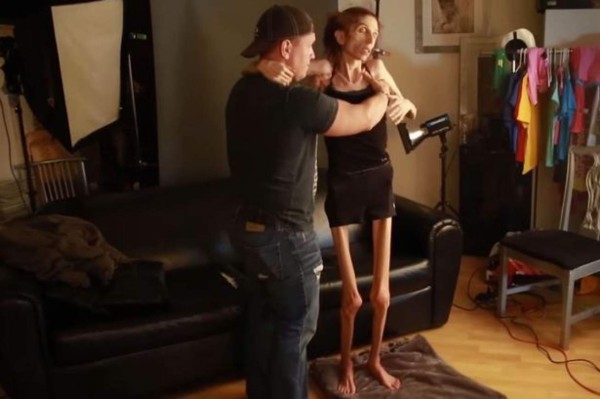 Actriz que sufre anorexia pide ayuda en Internet para salvar su vida