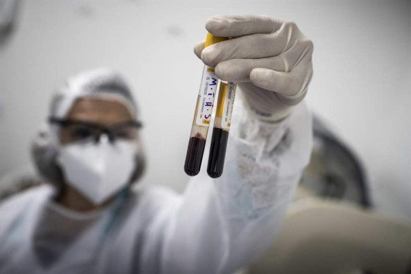 Un análisis de sangre indica qué enfermos de COVID-19 pueden empeorar