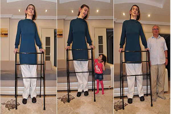 Rumeysa Gelgi es la joven más alta del mundo con 2.13 metros