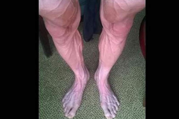 Así lucen las piernas de un ciclista en el Tour de Francia