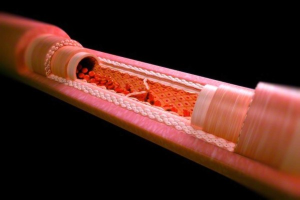 Desarrollan el vaso sanguíneo artificial más fino