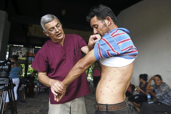 Enfermedad viral ataca a 200 familias de Honduras