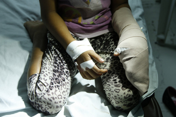 Mortero casi cercena mano de otro menor