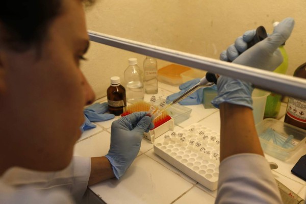 Confirman caso de malformación por zika