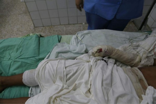 Lentamente se recupera niño quemado con pólvora