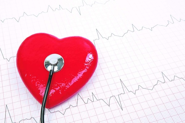 Las arritmias cardiacas deben tratarse para evitar una embolia