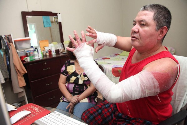 'Con una mesa me defendí de las llamas': sobreviviente de incendio en feria