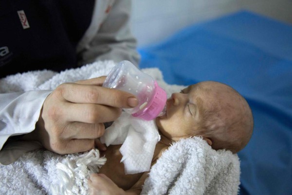 La brutal forma de nacer en Siria