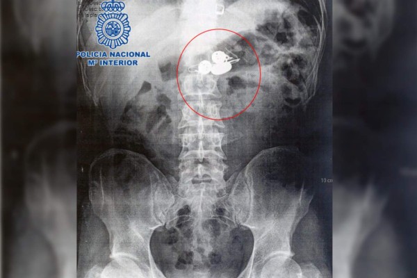 Ladrón se traga las joyas que robó antes de ser capturado