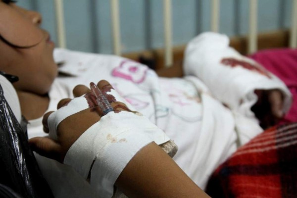 Un muerto y varios quemados por pólvora en Honduras