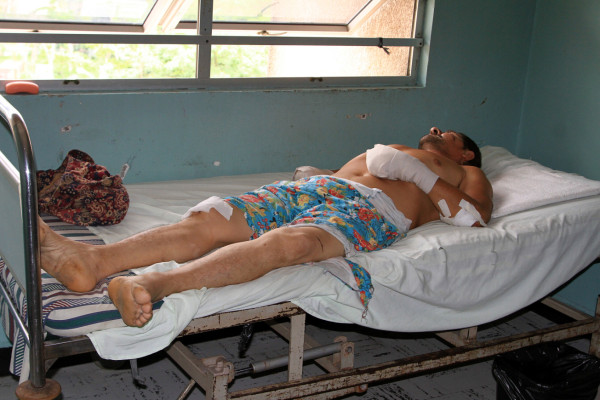 Hombre al que le cortaron manos pide ayuda