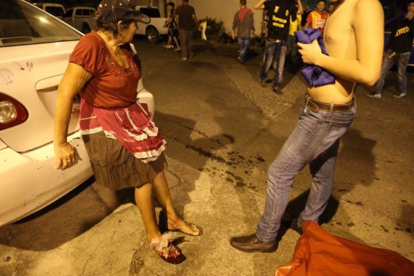 Una vendedora ambulante resultó herida durante los disturbios en las afueras del estadio Morazán en San Pedro Sula.