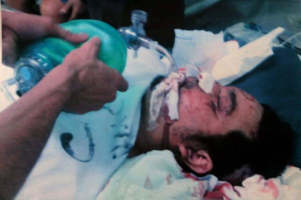 Hondureño que lucha por su vida, urge ayuda