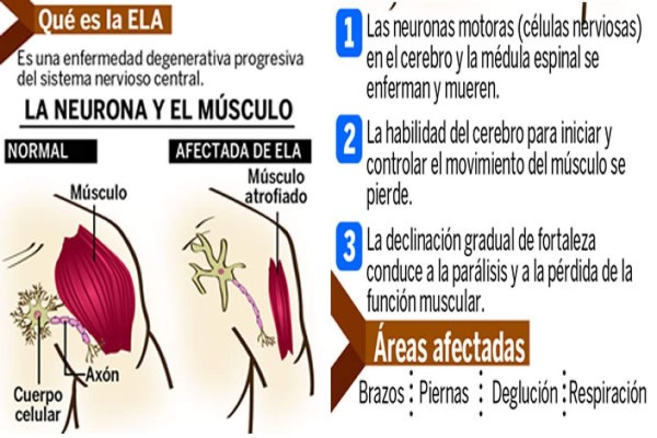 #Icebucketchallenge deja pocos recursos en Honduras