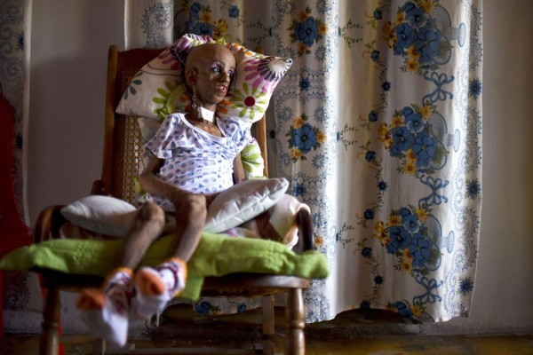 La quinceañera que envejeció antes de tiempo