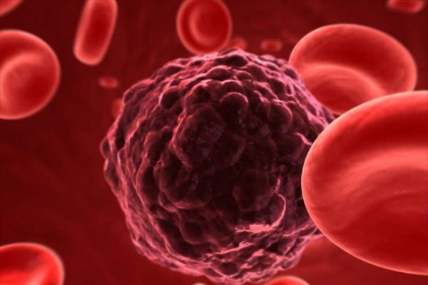 Los tumores eligen a qué órgano irá la metástasis y preparan el terreno