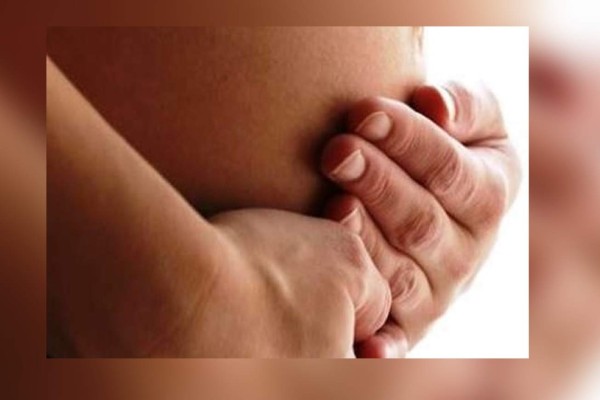 Feto permanece 36 años en el cuerpo de una mujer