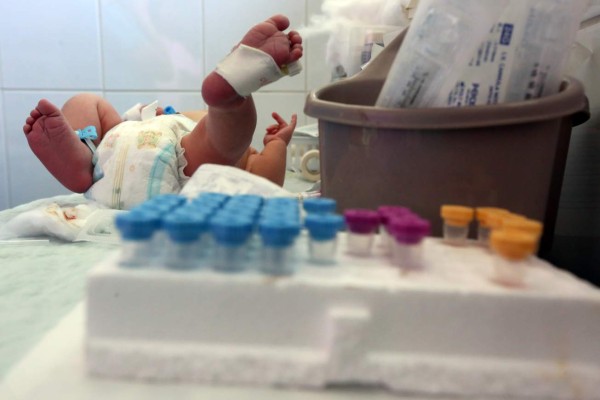 Salud reporta nacimiento de siete bebés más con microcefalia en Honduras